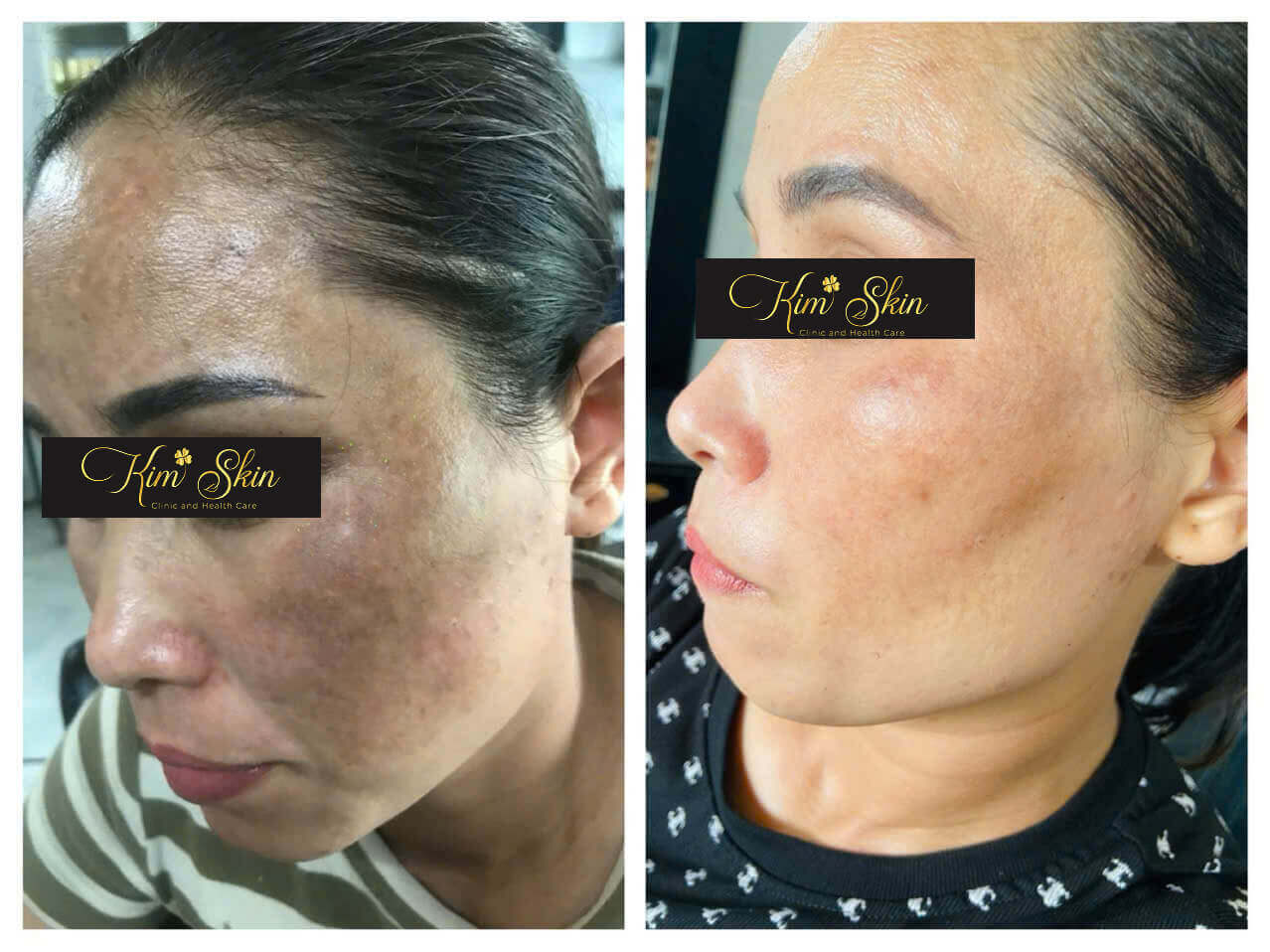 Spa Benefits